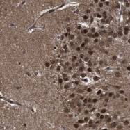 NBP1-81620 - TER ATPase / VCP